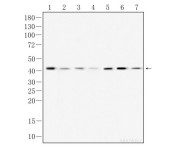 β-actin Mouse Monoclonal Antibody