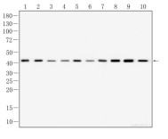 β-actin Mouse Monoclonal Antibody