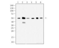 β-Tubulin Recombinant Rabbit Monoclonal Antibody