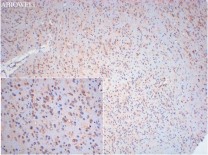 Calreticulin Recombinant Rabbit Monoclonal  Antibody