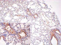 Calreticulin Recombinant Rabbit Monoclonal  Antibody