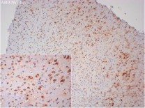 Calreticulin Recombinant Rabbit Monoclonal  Antibody