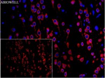 Calreticulin Recombinant Rabbit Monoclonal  Antibody