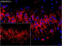 Calreticulin Recombinant Rabbit Monoclonal  Antibody