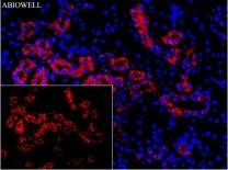 Calreticulin Recombinant Rabbit Monoclonal  Antibody