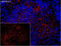 Calreticulin Recombinant Rabbit Monoclonal  Antibody