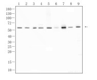 Calreticulin Recombinant Rabbit Monoclonal  Antibody