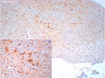 ABCA1 Rabbit Polyclonal Antibody