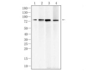 ACSL3 Rabbit Polyclonal Antibody