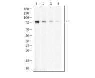 ACSL3 Rabbit Polyclonal Antibody