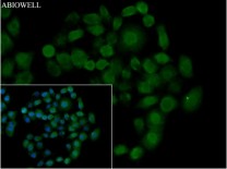 HMGB1 Rabbit Polyclonal Antibody