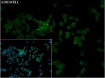 HMGB1 Rabbit Polyclonal Antibody