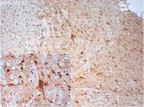 AKT1 Recombinant Rabbit Monoclonal Antibody