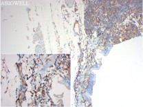 AKT1 Recombinant Rabbit Monoclonal Antibody