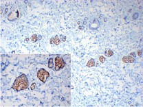 Claudin 1 Rabbit Polyclonal Antibody