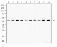 β-actin Recombinant Rabbit Monoclonal Antibody