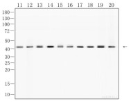 β-actin Recombinant Rabbit Monoclonal Antibody