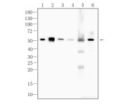 β III tubulin Rabbit Polyclonal Antibody