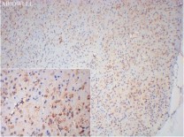 Cytokeratin 19 Recombinant Rabbit Monoclonal Antibody