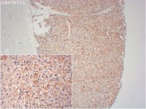 Cytokeratin 19 Recombinant Rabbit Monoclonal Antibody