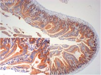 Cytokeratin 19 Recombinant Rabbit Monoclonal Antibody