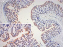 Cytokeratin 19 Recombinant Rabbit Monoclonal Antibody