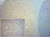 ATF4 Recombinant Rabbit Monoclonal Antibody