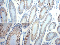 ATF4 Recombinant Rabbit Monoclonal Antibody