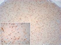 XBP1 Recombinant Rabbit Monoclonal  Antibody