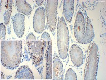 XBP1 Recombinant Rabbit Monoclonal  Antibody