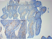 β III tubulin Rabbit Polyclonal Antibody