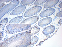 CDK2 Recombinant Rabbit Monoclonal Antibody