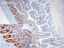 4EBP1 Recombinant Rabbit Monoclonal Antibody