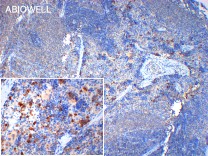 4EBP1 Recombinant Rabbit Monoclonal Antibody