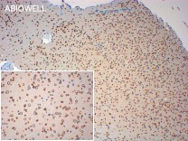 Lamin B1 Recombinant Rabbit Monoclonal Antibody