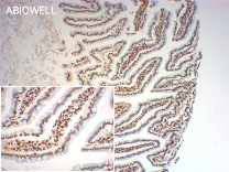 Lamin B1 Recombinant Rabbit Monoclonal Antibody