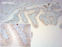 JAK1 Recombinant Rabbit Monoclonal  Antibody