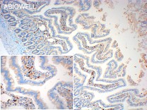 JAK1 Recombinant Rabbit Monoclonal  Antibody