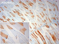 JAK1 Recombinant Rabbit Monoclonal  Antibody