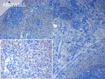 p53(Phospho Ser392) Rabbit Polyclonal Antibody