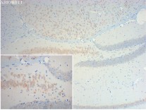 Nestin Recombinant Rabbit Monoclonal Antibody