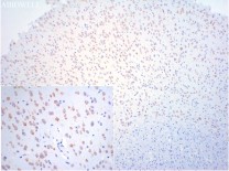 Nestin Recombinant Rabbit Monoclonal Antibody