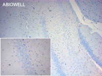 P2RY12 Recombinant Rabbit Monoclonal Antibody