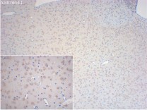 CHAT Recombinant Rabbit Monoclonal Antibody