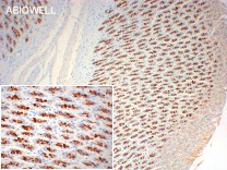 CHAT Recombinant Rabbit Monoclonal Antibody