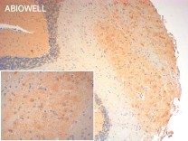 CHAT Recombinant Rabbit Monoclonal Antibody