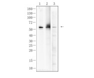 TH Rabbit Polyclonal Antibody