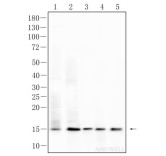 FABP1 Rabbit Polyclonal Antibody