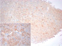 NEFH Recombinant Rabbit Monoclonal Antibody