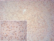 NEFH Recombinant Rabbit Monoclonal Antibody